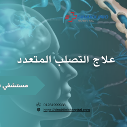 علاج التصلب المتعدد