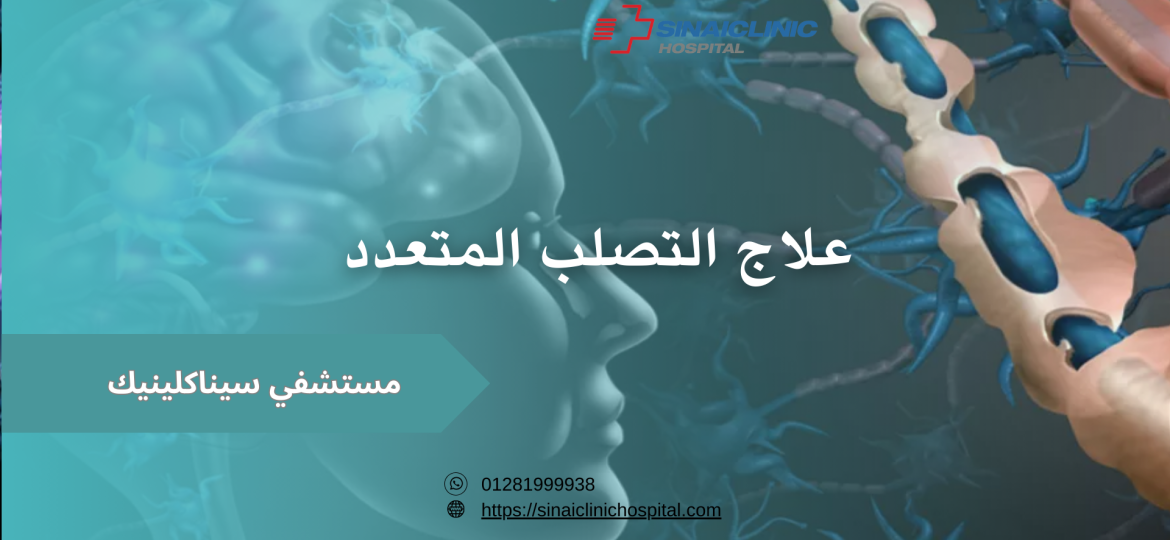 علاج التصلب المتعدد